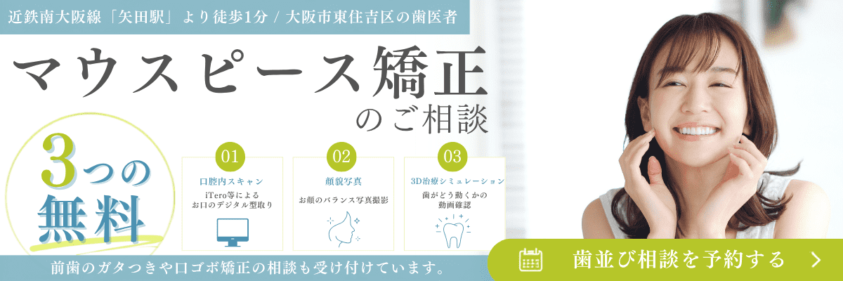 マウスピース矯正のご相談